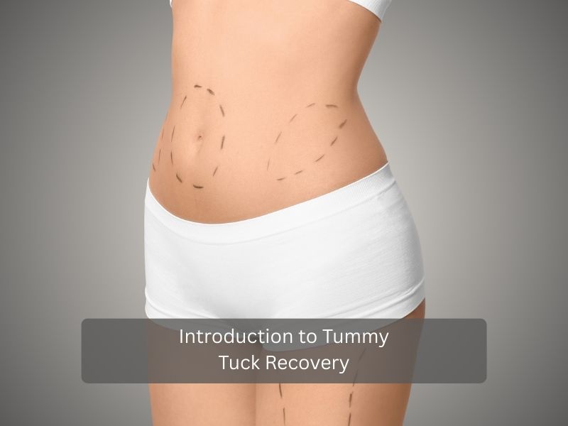 Introduction to Tummy Tuck Recovery Introduction to Tummy Tuck Recovery