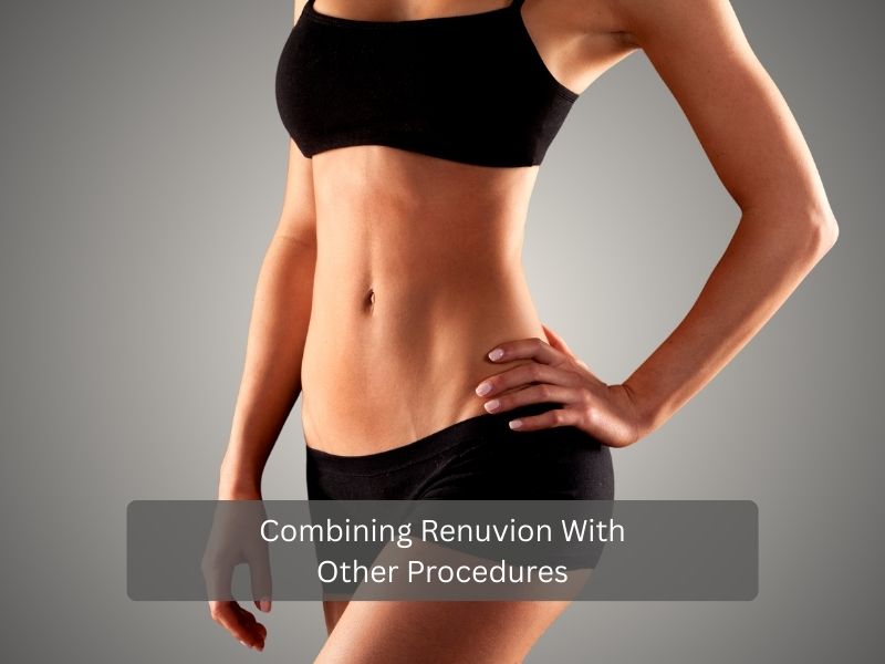 Combining Renuvion With Other Procedures Combining Renuvion With Other Procedures