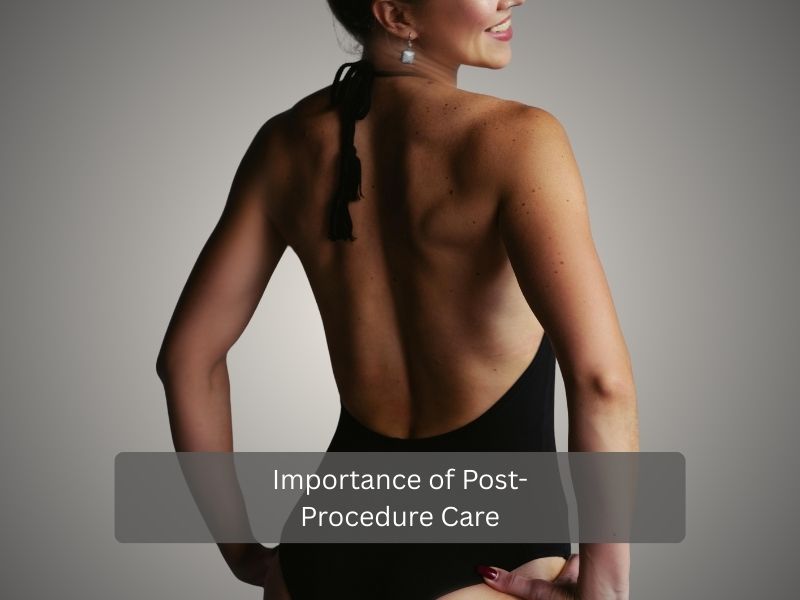 Importance of Post Procedure Care Importance of Post Procedure Care
