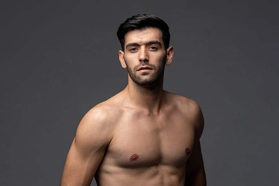 Gynecomastia Surgery San Diego CA