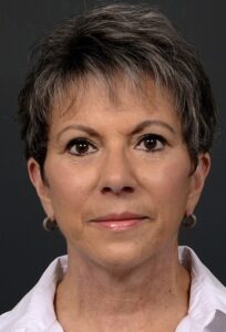 After Image: Facelift
