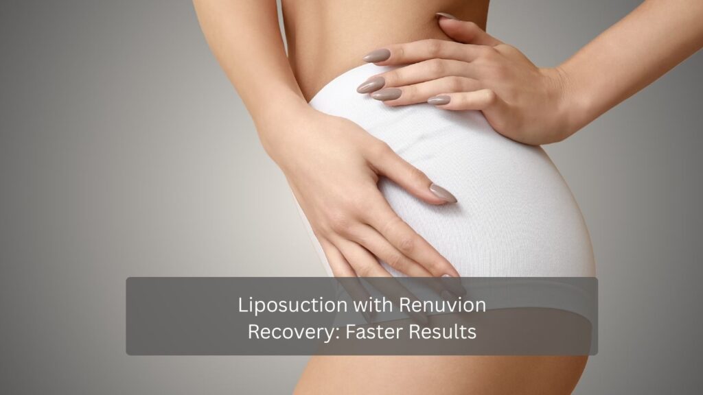 Liposuction with Renuvion Recovery