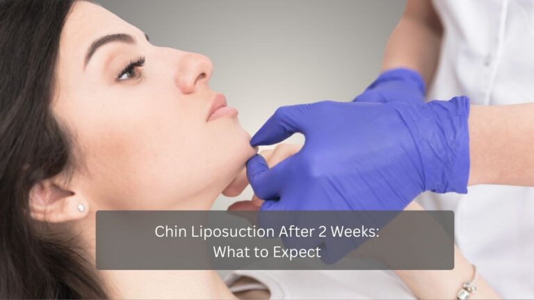 Chin Liposuction After 2 Weeks What to Expect