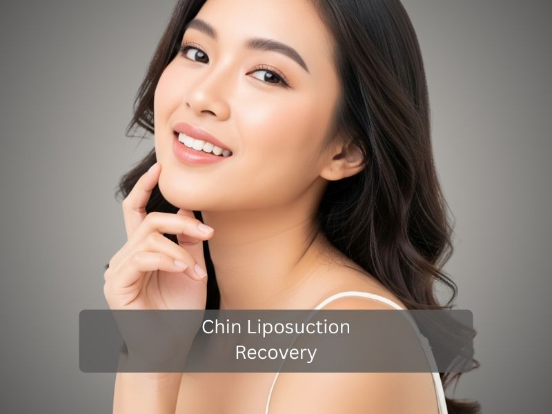 Chin Liposuction Recovery (1) Chin Liposuction Recovery