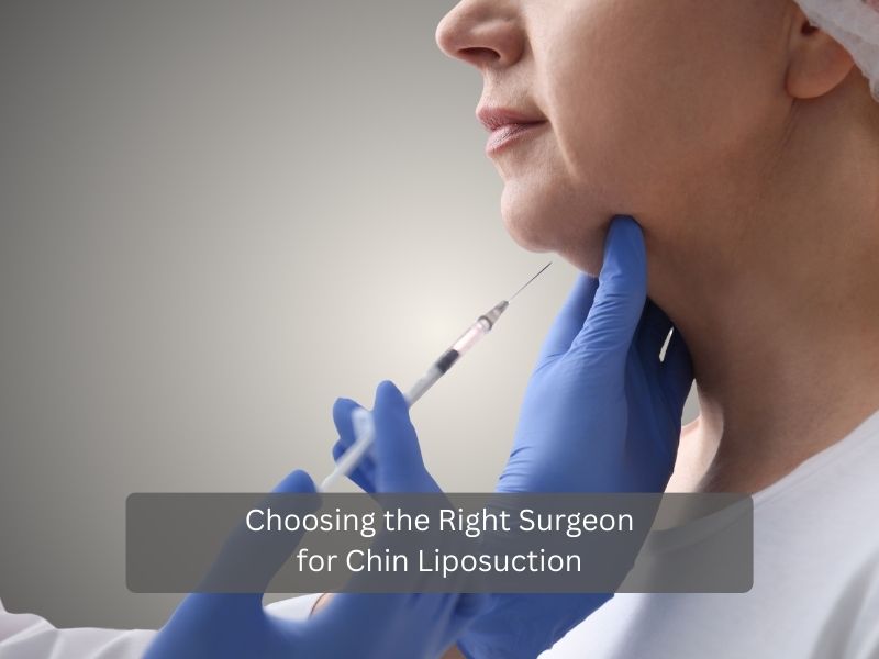Choosing the Right Surgeon for Chin Liposuction Choosing the Right Surgeon for Chin Liposuction