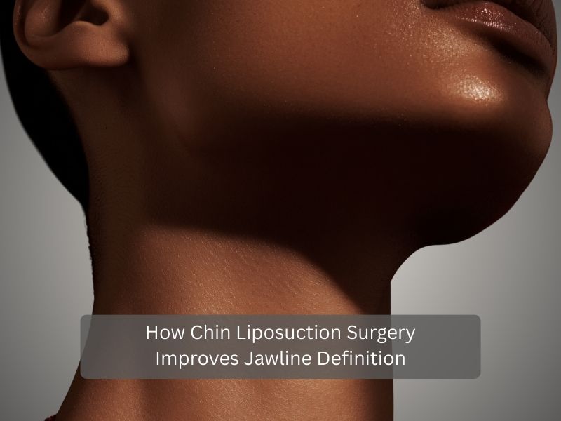 How Chin Liposuction Surgery Improves Jawline Definition How Chin Liposuction Surgery Improves Jawline Definition