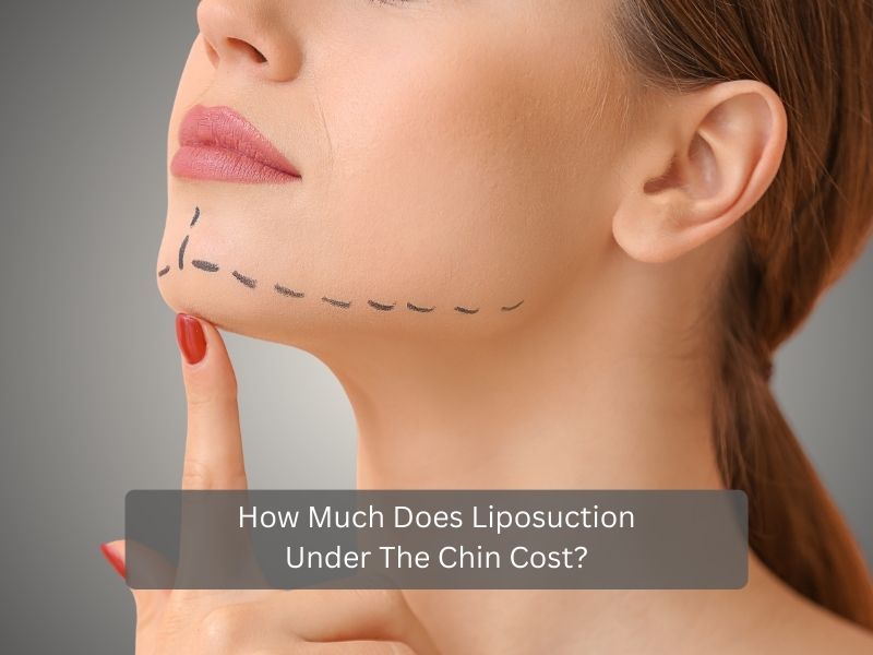 How Much Does Liposuction Under The Chin Cost How Much Does Liposuction Under The Chin Cost