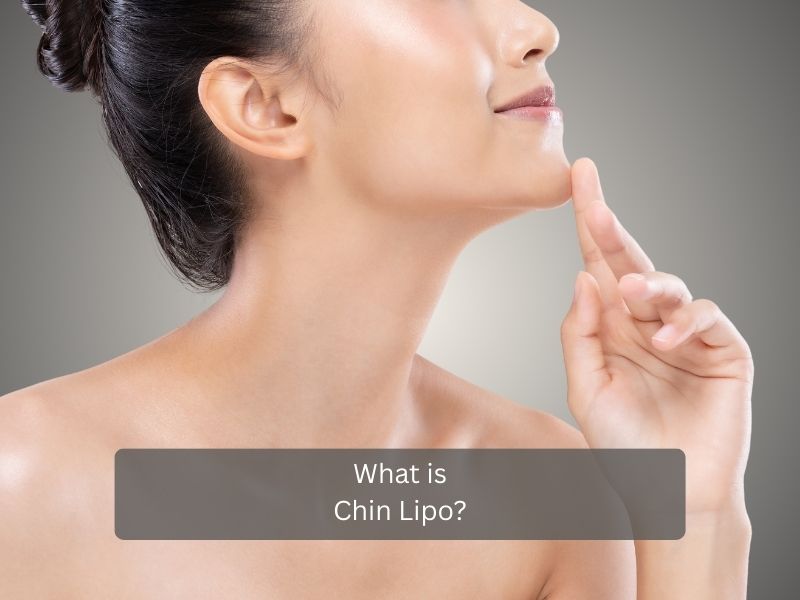 What is Chin Lipo What is Chin Lipo