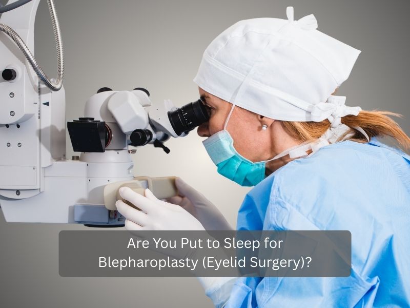 Are You Put to Sleep for Blepharoplasty (Eyelid Surgery) Are You Put to Sleep for Blepharoplasty (Eyelid Surgery)