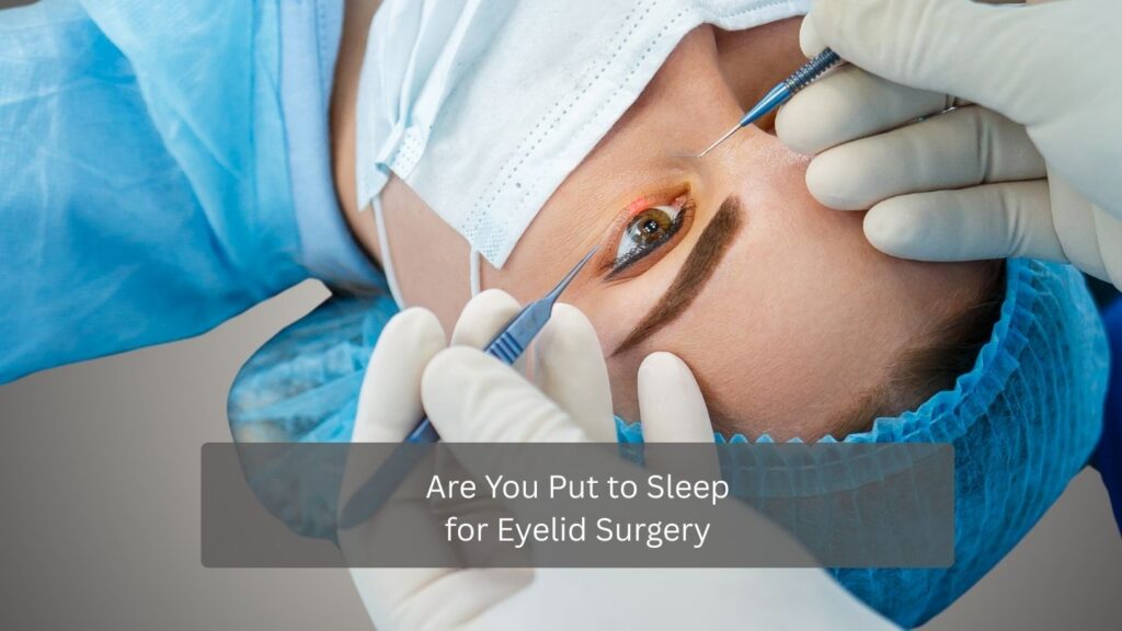 Are You Put to Sleep for Eyelid Surgery