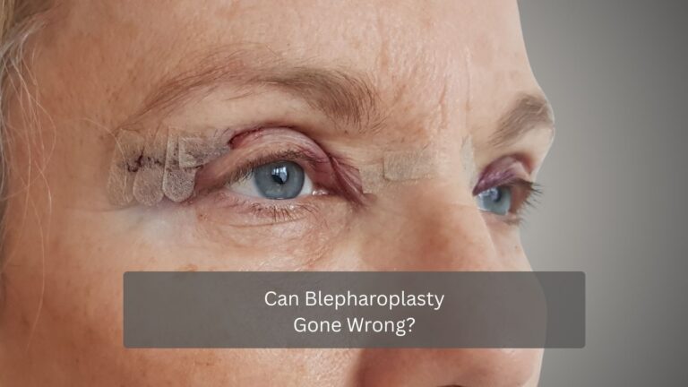 Can Blepharoplasty Gone Wrong