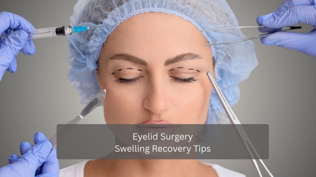 Eyelid Surgery Swelling Recovery Tips
