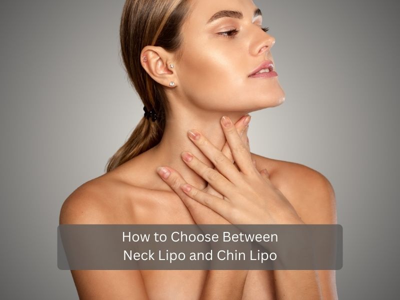 How to Choose Between Neck Lipo and Chin Lipo How to Choose Between Neck Lipo and Chin Lipo