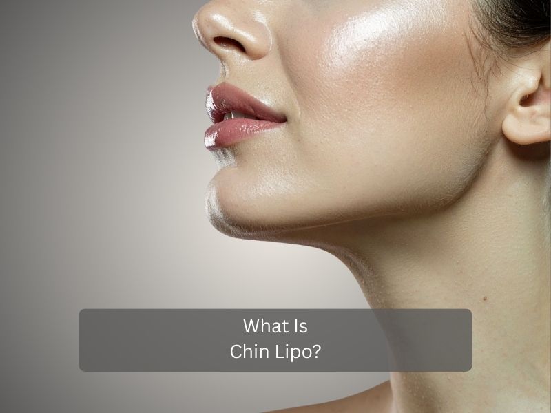 What Is Chin Lipo What Is Chin Lipo