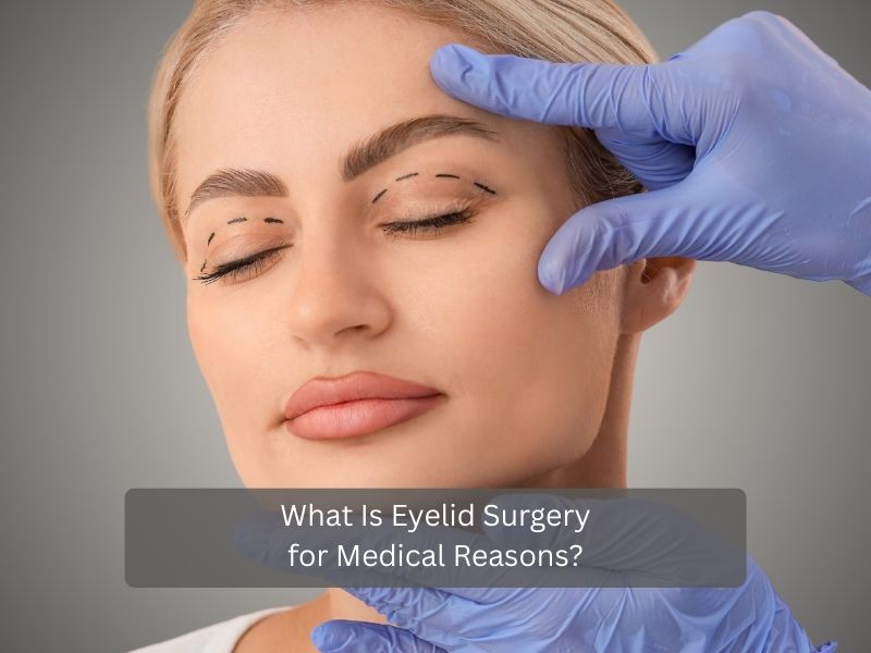 What Is Eyelid Surgery for Medical Reasons What Is Eyelid Surgery for Medical Reasons