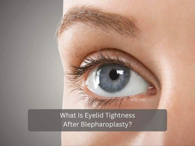 What Is Eyelid Tightness After Blepharoplasty What Is Eyelid Tightness After Blepharoplasty