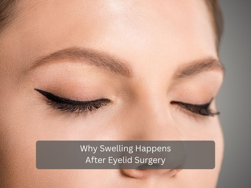 Why Swelling Happens After Eyelid Surgery Why Swelling Happens After Eyelid Surgery