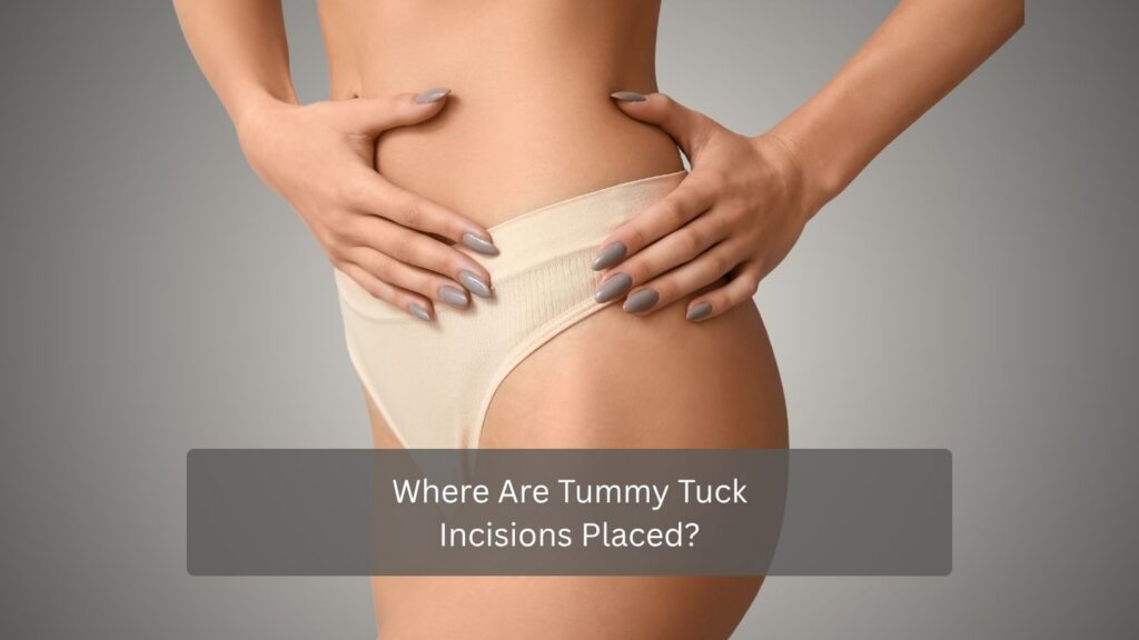 Where Are Tummy Tuck Incisions Placed