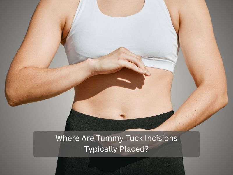 Where Are Tummy Tuck Incisions Typically Placed Where Are Tummy Tuck Incisions Typically Placed