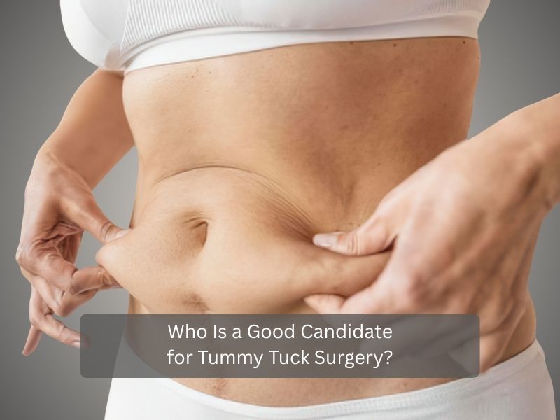 Who Is a Good Candidate for Tummy Tuck Surgery Who Is a Good Candidate for Tummy Tuck Surgery